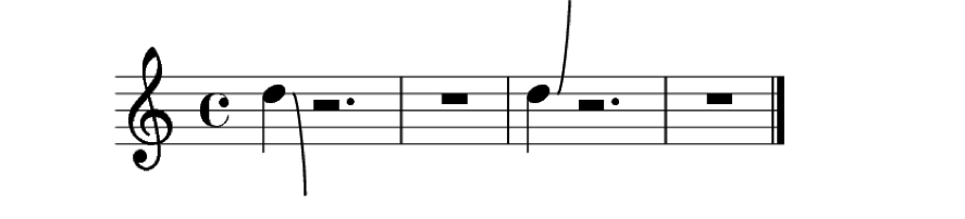 Partitura con ejemplos de marcas de respiración